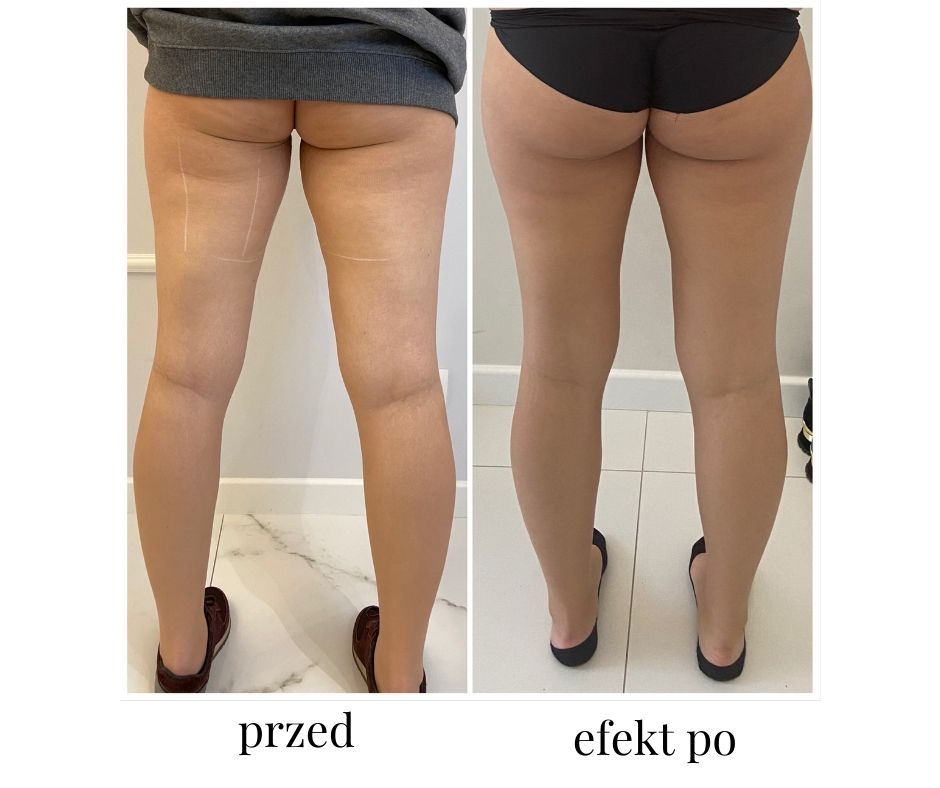 przed-1.jpg