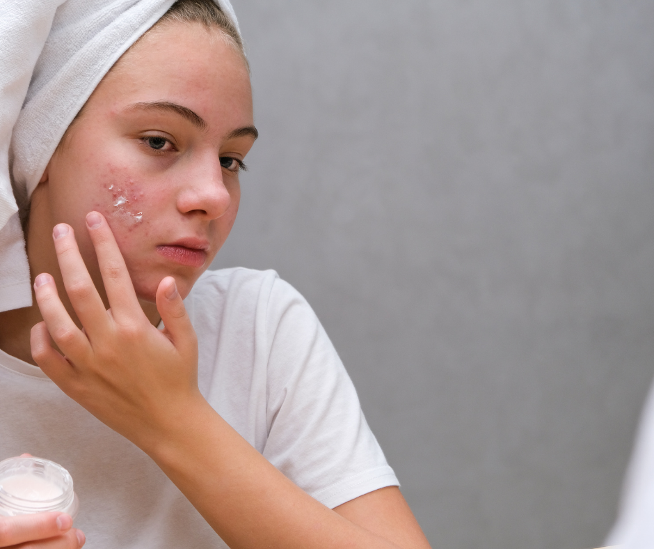 Post-accident scars