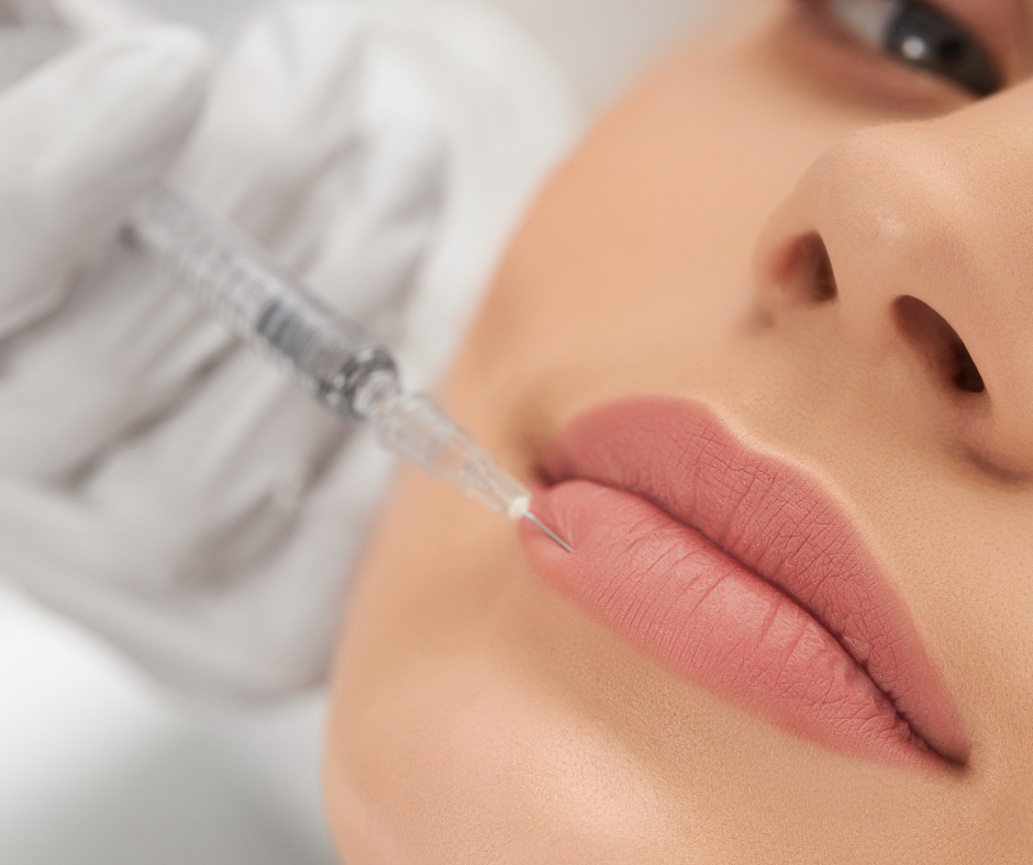 lip augmentation