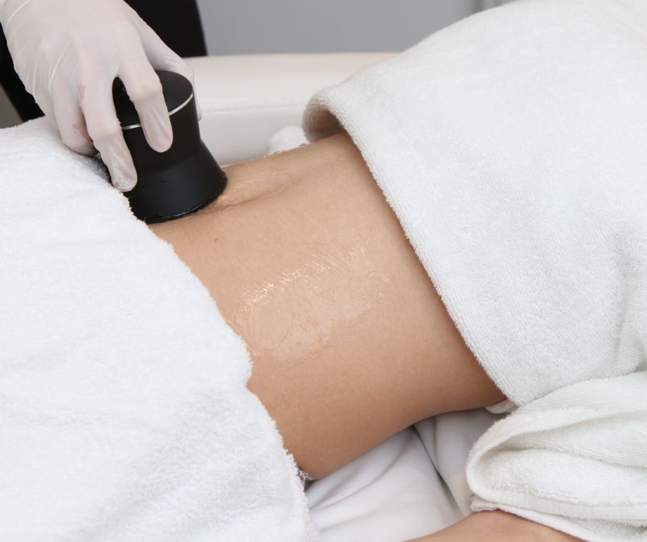 Liposukcja laserowa - ile można schudnąć po zabiegu?