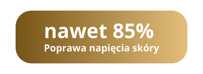 Wykres poprawy napięcia